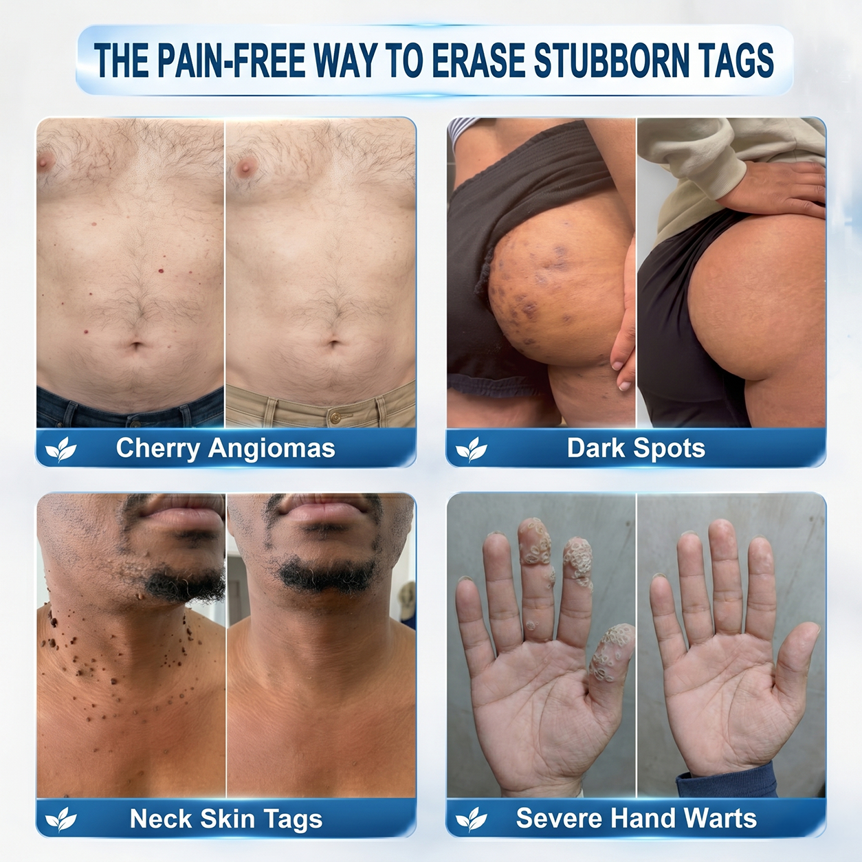 𝐎𝐟𝐟𝐢𝐜𝐢𝐚𝐥 𝐁𝐫𝐚𝐧𝐝 𝐒𝐭𝐨𝐫𝐞 |𝐇𝐞𝒂𝒍𝗿𝗶𝙯𝙚® 🖊️7-𝒟𝘢𝑦 𝑇𝘢𝗴 & 𝗦𝐩𝐨𝒕 𝑬𝒓𝗮𝘀𝖾𝗋(Zero Pain, Zero 𝐒𝐜𝐚𝒓𝒔 Rollerball)👩‍⚕️