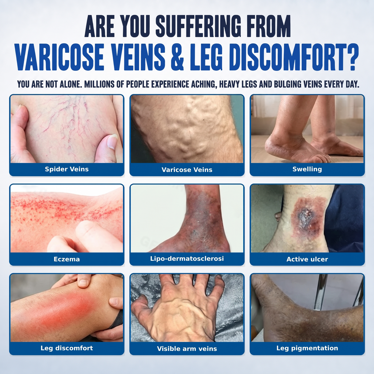 Consistency = Better Leg Care! 🦵✨Enjoy a limited-time 30% OFF 𝑯𝗲𝙖𝐥𝒓𝗶𝙯𝗲®! Many customers choose the 6-box bundle for a complete, consistent vein-care routine—while also locking in our best-value savings. Don’t miss out! 👍⏰