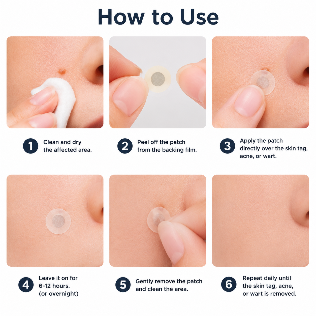 ✅🇦🇺𝐇𝐞𝒂𝒍𝗿𝗶𝙯𝙚®2-in-1 Microneedle & Hydrocolloid Patch🔥| Removes Raised Moles, Acne, Flat Warts & Skin Tags | Helps Improve Wrinkles, Scars & Blemishes | Invisible Patches for Face & Body