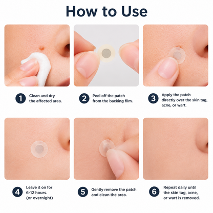 ✅🇦🇺𝐇𝐞𝒂𝒍𝗿𝗶𝙯𝙚®2-in-1 Microneedle & Hydrocolloid Patch🔥| Removes Raised Moles, Acne, Flat Warts & Skin Tags | Helps Improve Wrinkles, Scars & Blemishes | Invisible Patches for Face & Body