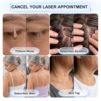 【 🔥Last Day Promotion 70% OFF🔥】🇦🇺𝐇𝐞𝒂𝒍𝗿𝗶𝙯𝙚®2-in-1 Microneedle & Hydrocolloid Patch| Removes Raised Moles, Acne, Flat Warts & Skin Tags | Helps Improve Wrinkles, Scars & Blemishes | Invisible Patches for Face & Body