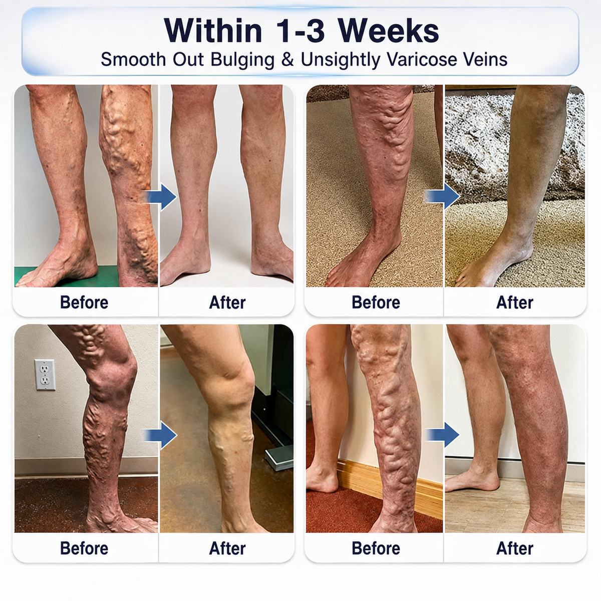 Consistency = Better Leg Care! 🦵✨Enjoy a limited-time 30% OFF 𝑯𝗲𝙖𝐥𝒓𝗶𝙯𝗲®! Many customers choose the 6-box bundle for a complete, consistent vein-care routine—while also locking in our best-value savings. Don’t miss out! 👍⏰