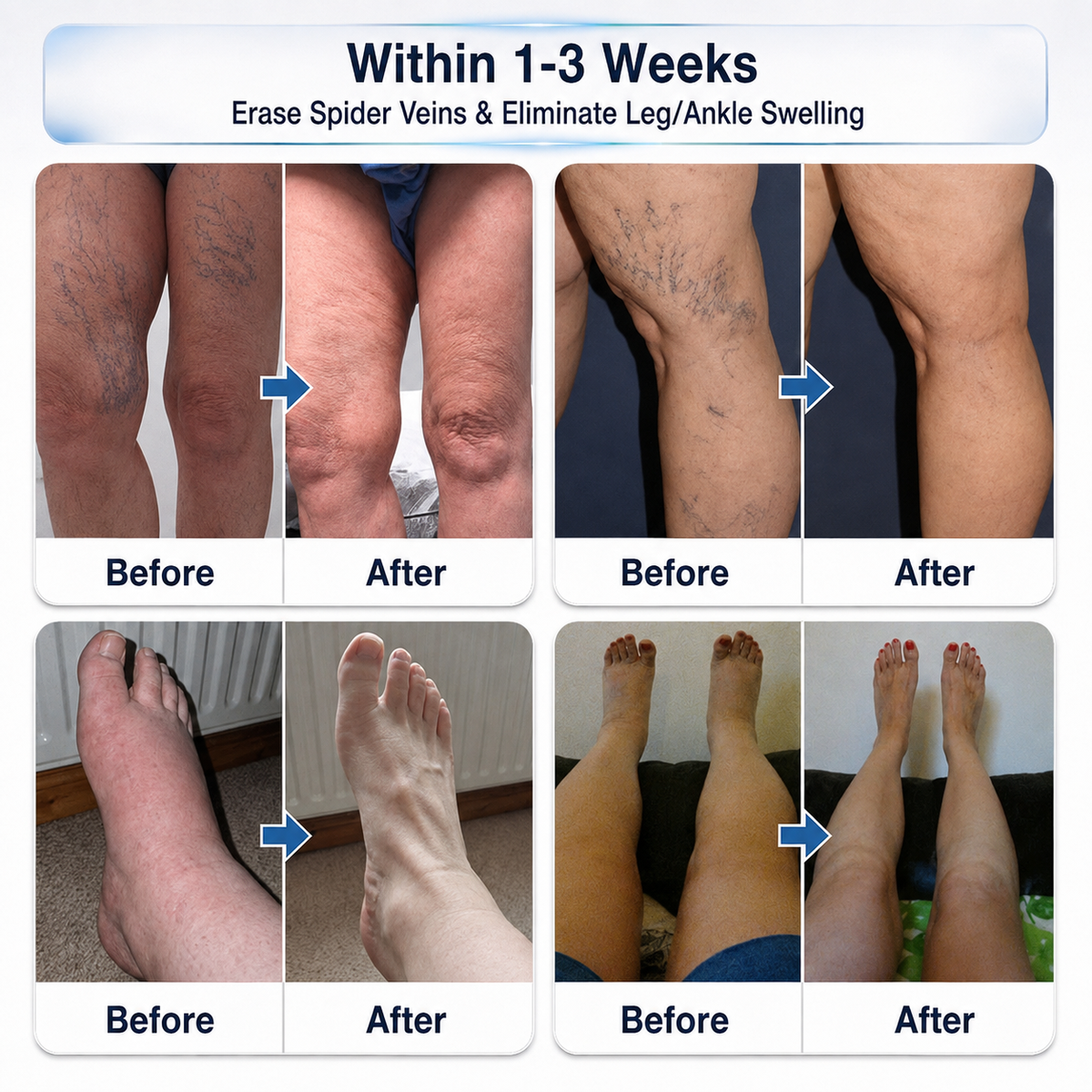 Consistency = Better Leg Care! 🦵✨Enjoy a limited-time 30% OFF 𝑯𝗲𝙖𝐥𝒓𝗶𝙯𝗲®! Many customers choose the 6-box bundle for a complete, consistent vein-care routine—while also locking in our best-value savings. Don’t miss out! 👍⏰